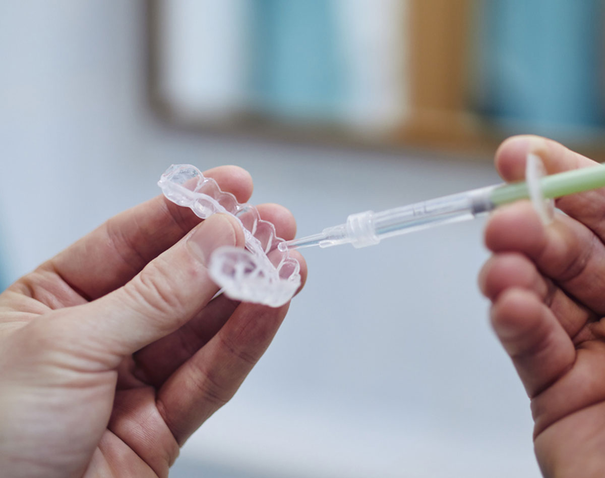 Tooth whitening treatment